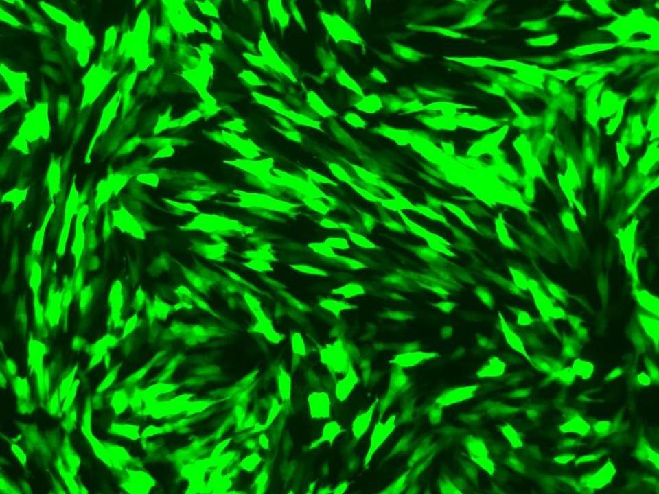 NEPA21 / Primary - Human Endometrial Stromal Cells - Transfection Efficiency 90 per cent